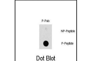 Dot blot analysis of Phospho-HSBP1-S78 polyclonal antibody (ABIN389744 and ABIN2839677) on nitrocellulose membrane. (HSP27 anticorps  (pSer78))