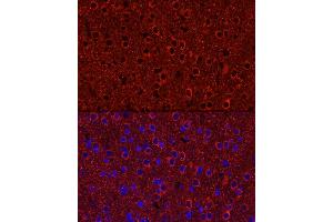 Immunofluorescence analysis of Rat brain using P2Y12 antibody (ABIN7269752) at dilution of 1:50 (40x lens). (P2RY12 anticorps)