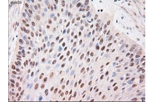 Immunohistochemical staining of paraffin-embedded kidney using anti-Stat4 (ABIN2452527) mouse monoclonal antibody. (STAT4 anticorps  (AA 633-652))