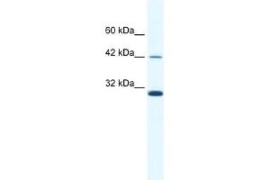 WB Suggested Anti-APOBEC3G Antibody   Titration: 2. (APOBEC3G anticorps  (N-Term))