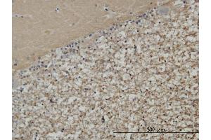 Immunoperoxidase of monoclonal antibody to STXBP1 on formalin-fixed paraffin-embedded human cerebellum.