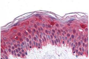 Human Skin: Formalin-Fixed, Paraffin-Embedded (FFPE) (LHX8 anticorps  (AA 1-321))