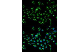Immunofluorescence analysis of MCF-7 cells using CDKN3 antibody (ABIN5971092). (CDKN3 anticorps)