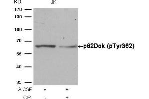 Western blot analysis of extracts from JK cells, treated with G-CSF or calf intestinal phosphatase (CIP), using p62Dok (phospho-Tyr362) Antibody.