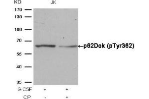 Western blot analysis of extracts from JK cells, treated with G-CSF or calf intestinal phosphatase (CIP), using p62Dok (phospho-Tyr362) Antibody. (DOK1 anticorps  (pTyr362))