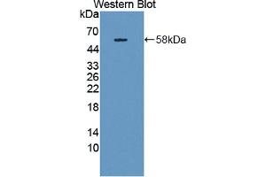 Figure. (THBS3 anticorps  (AA 670-921))