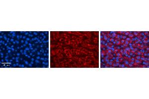 FMO5 antibody - middle region          Formalin Fixed Paraffin Embedded Tissue:  Human Liver Tissue    Observed Staining:  Cytoplasm in hepatocytes   Primary Antibody Concentration:  1:600    Secondary Antibody:  Donkey anti-Rabbit-Cy3    Secondary Antibody Concentration:  1:200    Magnification:  20X    Exposure Time:  0.
