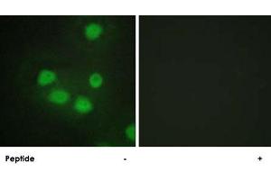 Immunofluorescence analysis of HepG2 cells, using SIX6 polyclonal antibody . (SIX Homeobox 6 anticorps)