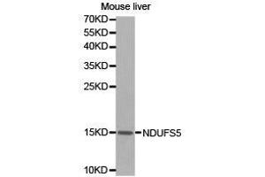 Western Blotting (WB) image for anti-NADH Dehydrogenase (Ubiquinone) Fe-S Protein 5, 15kDa (NADH-Coenzyme Q Reductase) (NDUFS5) antibody (ABIN1873864) (NDUFS5 anticorps)