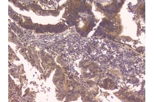 IHC analysis of TNFRSF11B using anti-TNFRSF11B antibody (ABIN7600875).