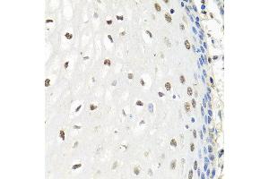 Immunohistochemistry of paraffin-embedded human esophagus using CNOT8 antibody at dilution of 1:100 (x40 lens). (CNOT8 anticorps)