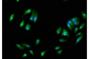 Immunofluorescence staining of Hela cells with ABIN7167480 at 1:266, counter-stained with DAPI. (RIPK3 anticorps  (AA 1-518))