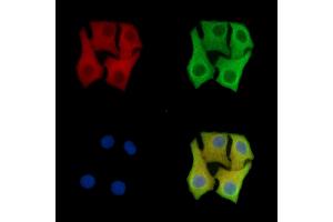 ABIN7096418 and ABIN7100482 staining Hela cells by IF/ICC.