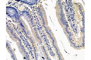 ABIN7095075 and ABIN7099131 at 1/100 staining rat colorectal tissue by IHC-P. (CRB3 anticorps)