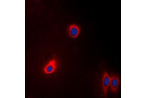 Immunofluorescent analysis of EEF2 staining in A431 cells. (EEF2 anticorps  (N-Term))