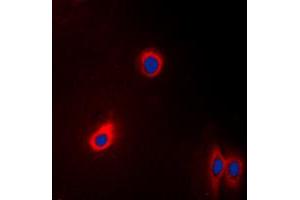 Immunofluorescent analysis of EEF2 staining in A431 cells.