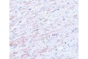 Immunohistochemistry of TCF3 in rat liver tissue with this product at 5 μg/ml. (TCF3 anticorps  (N-Term))