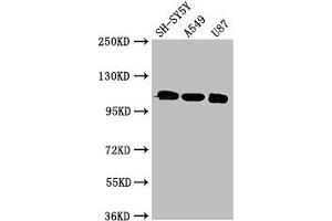 Western Blot Positive WB detected in: SH-SY5Y whole cell lysate, A549 whole cell lysate, U87 whole cell lysate All lanes: LRP8 antibody at 3 μg/mL Secondary Goat polyclonal to rabbit IgG at 1/50000 dilution Predicted band size: 106, 78, 100, 88 kDa Observed band size: 106 kDa (LRP8 anticorps  (AA 131-332))