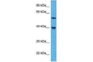 Host:  Rabbit  Target Name:  SLC39A5  Sample Tissue:  Human Jurkat Whole Cell  Antibody Dilution:  1ug/ml