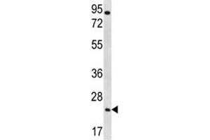 AQP5 antibody western blot analysis in NCI-H292 lysate (Aquaporin 5 anticorps  (AA 227-256))