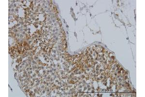 Immunoperoxidase of monoclonal antibody to GYG1 on formalin-fixed paraffin-embedded human testis.