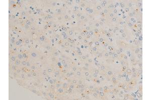 ABIN6267270 at 1/100 staining human liver tissue sections by IHC-P. (c-FOS anticorps  (pSer362))