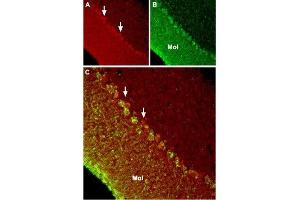 Expression of TRPC6 in mouse cerebellum - Immunohistochemical staining of mouse cerebellum using Anti-TRPC6 Antibody (ABIN7043824, ABIN7043968 and ABIN7043969).