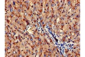 Immunohistochemistry of paraffin-embedded human liver tissue using ABIN7144005 at dilution of 1:100