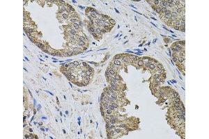 Immunohistochemistry of paraffin-embedded Human prostate using IGSF3 Polyclonal Antibody (IGSF3 anticorps)