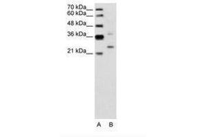 Image no. 2 for anti-Defective in Cullin Neddylation 1, Domain Containing 1 (DCUN1D1) (AA 31-80) antibody (ABIN6736642) (DCUN1D1 anticorps  (AA 31-80))