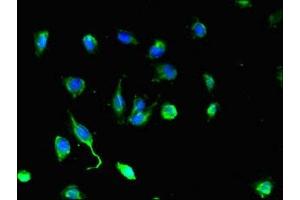 Immunofluorescent analysis of U251 cells using ABIN7149892 at dilution of 1:100 and Alexa Fluor 488-congugated AffiniPure Goat Anti-Rabbit IgG(H+L) (DEF6 anticorps  (AA 20-114))