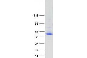 Validation with Western Blot