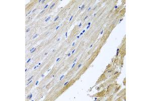 Immunohistochemistry of paraffin-embedded rat heart using PRPH antibody at dilution of 1:100 (x40 lens). (Peripherin anticorps)