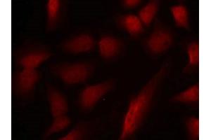 Immunofluorescence staining of methanol-fixed Hela cells using GATA1(Phospho-Ser310) Antibody. (GATA1 anticorps  (pSer310))