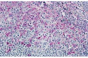 anti-Chemokine (C-C Motif) Receptor 8 (CCR8) (Cytoplasmic Domain) antibody