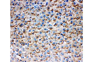 Anti-HSD17B1 antibody, IHC(P): Rat Liver Tissue