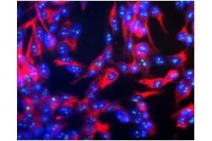 Immunofluorescence (IF) image for anti-Fibrillarin (FBL) antibody (ABIN371824)