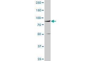 VCAM1 MaxPab rabbit polyclonal antibody. (VCAM1 anticorps  (AA 1-739))