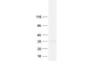 Validation with Western Blot