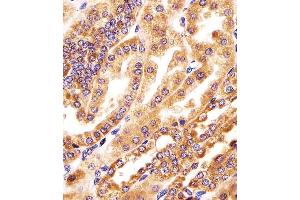 (ABIN6244258 and ABIN6578390) staining GMCL1 in human kidney tissue sections by Immunohistochemistry (IHC-P - paraformaldehyde-fixed, paraffin-embedded sections). (GMCL1 anticorps  (AA 281-315))