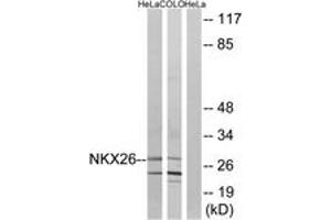 Western blot analysis of extracts from HeLa/COLO cells, using NKX26 Antibody. (NKX2-6 anticorps  (AA 91-140))