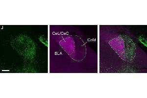 High magnification view of the central amygdala (CeA) ipsilateral to the insula with an AAV injection in mouse.
