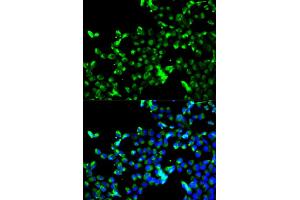 Immunofluorescence analysis of A549 cells using CALR antibody. (Calreticulin anticorps)