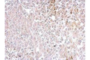 IHC-P Image Chromogranin C antibody detects SCG2 protein at cytosol on rat RT2 xenograft by immunohistochemical analysis. (SCG2 anticorps)