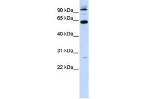 Image no. 1 for anti-MNT, MAX Dimerization Protein (MNT) (N-Term) antibody (ABIN6740600) (MNT anticorps  (N-Term))