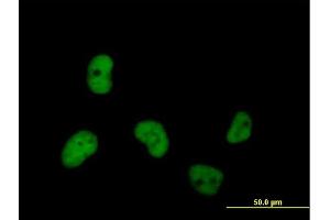 Immunofluorescence of purified MaxPab antibody to MCM7 on HeLa cell. (MCM7 anticorps  (AA 1-719))