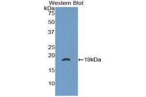 Detection of Recombinant NT, Human using Polyclonal Antibody to Neurotensin (NT)