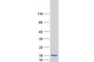 Validation with Western Blot