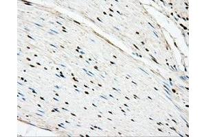 Immunohistochemical staining of paraffin-embedded liver tissue using anti-BSG mouse monoclonal antibody. (CD147 anticorps)