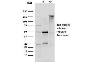 SDS-PAGE Analysis Purified IL-10R1 Rat Monoclonal Antibody (1B1. (IL-10RA anticorps)
